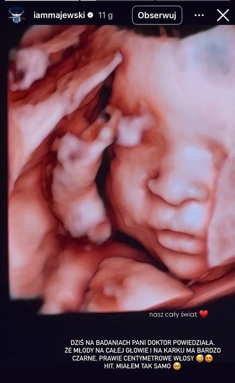 Deynn i Majewski dzielą się emocjami z badania USG