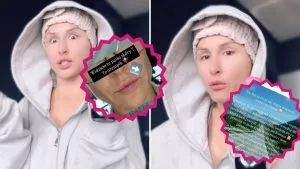 „Nowa twarz” Blanki Lipińskiej SZOKUJE. Ujawnia kulisy LIFTINGU: „Ciągnie mnie wszystko w tej twarzy” „Nowa twarz” Blanki Lipińskiej SZOKUJE. Ujawnia kulisy LIFTINGU: „Ciągnie mnie wszystko w tej twarzy”