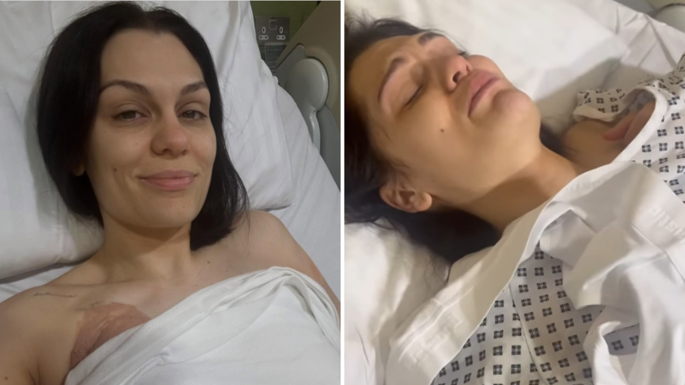 Jessie J relacjonuje swój stan po operacji raka piersi