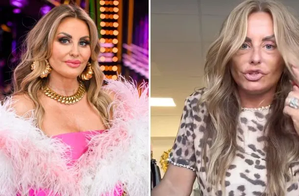 Dagmara Kaźmierska tak wygląda tydzień po liftingu. Fan: „Aż spadłem z łóżka!”