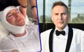 Krzysztof Gojdź zafundował sobie operację twarzy! „Zamiast kupować nowe Ferrari, wolałem…wydać na lifting”