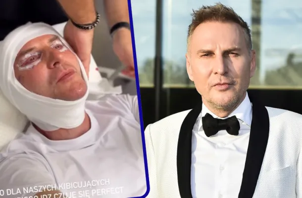 Krzysztof Gojdź zafundował sobie operację twarzy! „Zamiast kupować nowe Ferrari, wolałem…wydać na lifting”