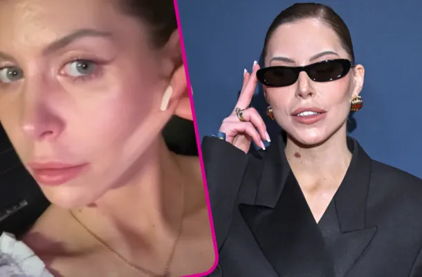 Julia von Stein zdradza, dlaczego zrobiła lifting twarzy: „Zdrowotnie wszystko się po********ło”(WIDEO)