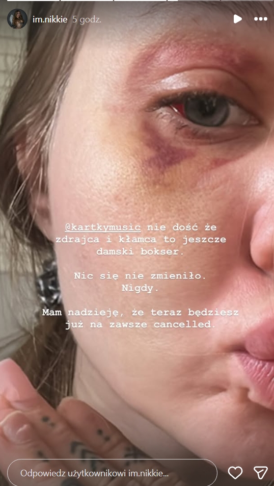 Partnerka Kartky'ego wyjawiła prawdę, fot. Instagram