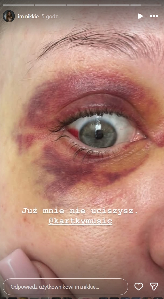 Partnerka Kartky'ego wyjawiła prawdę, fot. Instagram