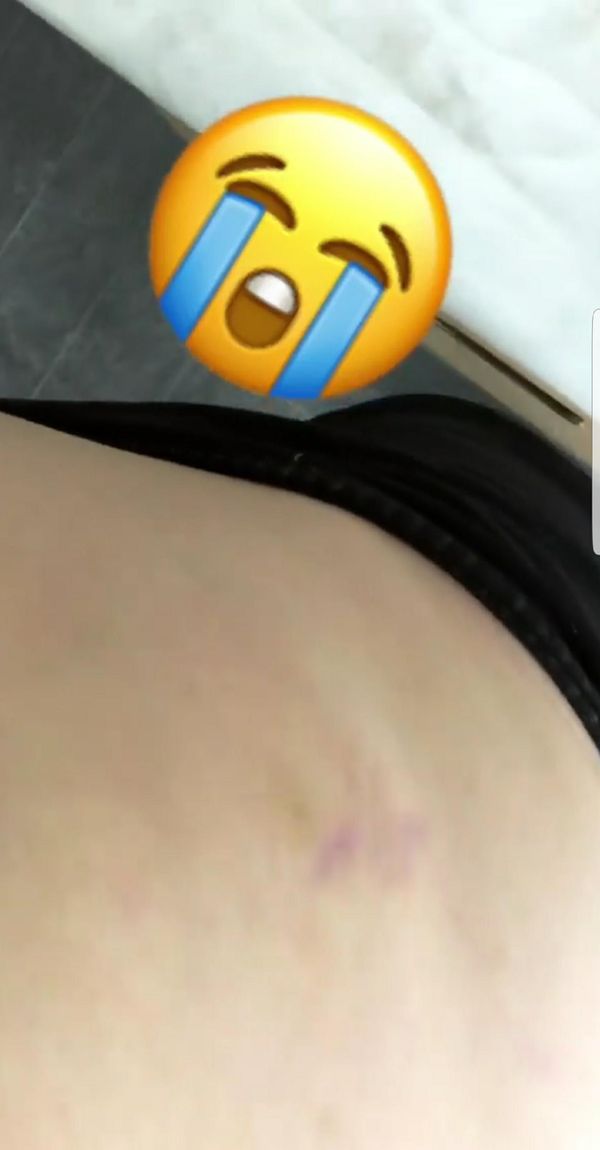 Chrissy Teigen załamana! „I na co były te wszystkie kremy na rozstępy?!” Chrissy Teigen załamana! „I na co były te wszystkie kremy na rozstępy?!”