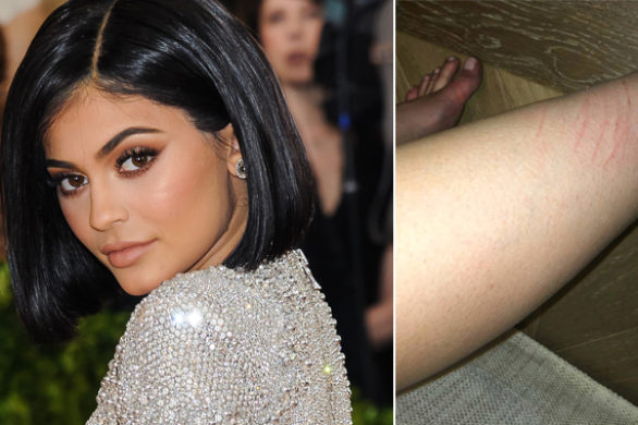 Kylie Jenner pokazała, że noszenie pięknych sukni jest… bolesne