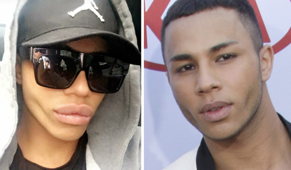 Olivier Rousteing stał się kolejną ofiarą operacji plastycznych? (FOTO) Olivier Rousteing stał się kolejną ofiarą operacji plastycznych? (FOTO)