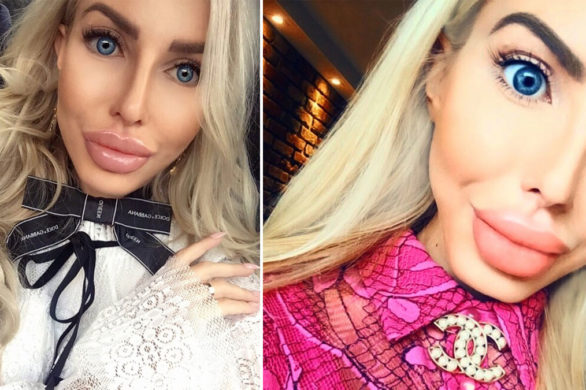 Polska Barbie kłóci się z chirurgiem plastycznym: „widzimisię” pani doktor…