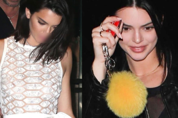 Po tych zdjęciach Kendall Jenner już na pewno nie wyprze się powiększania ust!