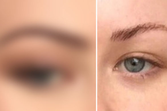 Ta dziewczyna miała brzydki kształt brwi. Zdecydowała się na microblading i…