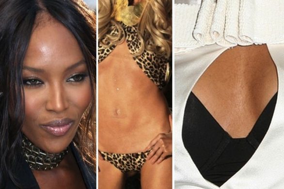 Wstydliwe defekty gwiazd i modelek (FOTO)