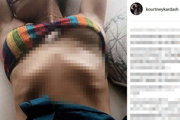 #BikiniBridge ma niebezpiecznego następcę – #RibcageBragging