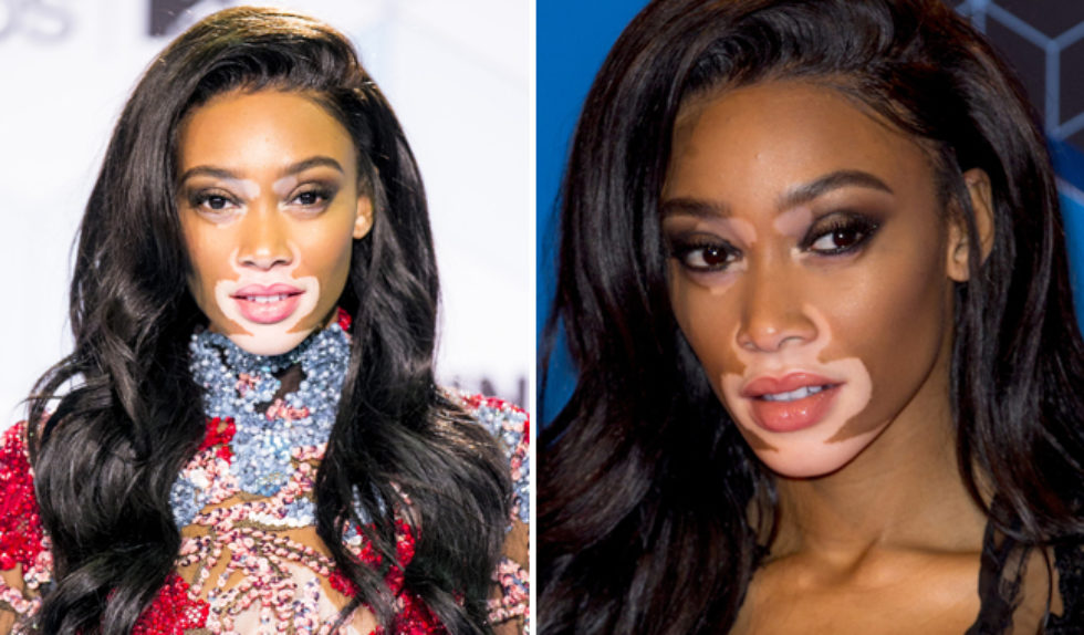 Jak Winnie Harlow wypadła na wczorajszej gali MTV Europe Music Awards 2016?