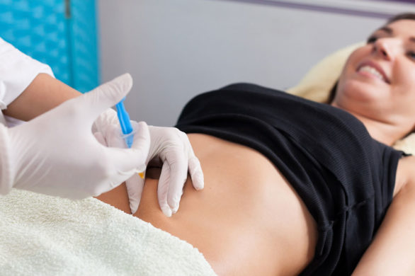 Przetestowałam karboksyterapię i zastanawiam się… dlaczego kobiety to robią?!