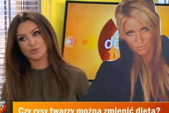 Monika Pietrasińska o swoich operacjach plastycznych