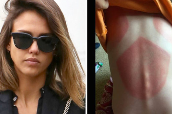 Kremy do opalania marki Jessiki Alby całkiem nieskuteczne?