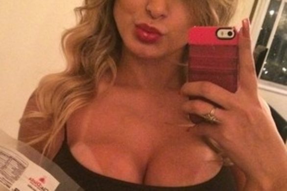 Ciało prezenterki Andressy Urach gniło przez wypełniacze!