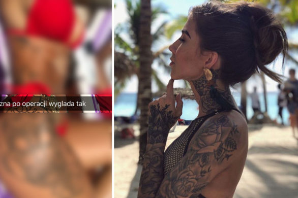 Deynn pokazała, jak wyglądają jej blizny po powiększaniu piersi (FOTO)