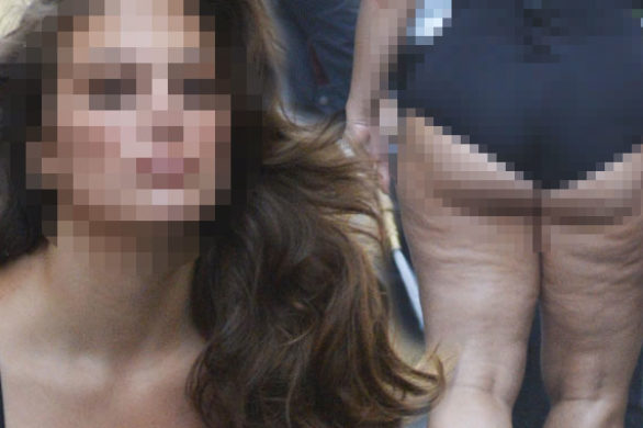 Wielu uważa ją za największą seksbombę. Spójrzcie tylko na jej cellulit!