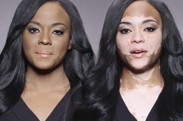 Poznajcie niezwykłą historię Cheri Lindsay (VIDEO)