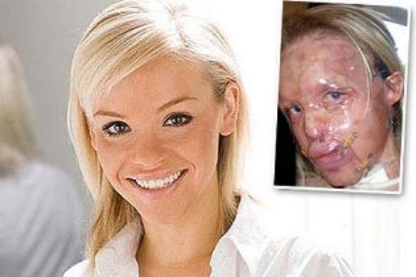 Szokująca historia Katie Piper