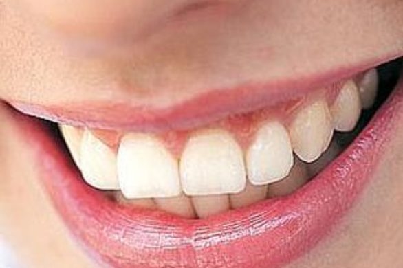 Do dentysty chodzimy dwa razy częściej niż do ginekologa