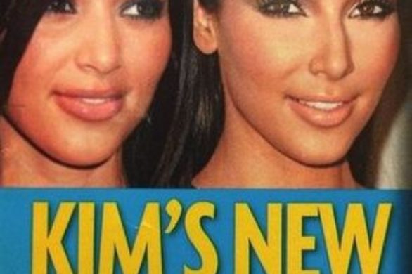 Czy Kim Kardashian miała operacje plastyczne?
