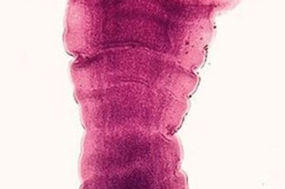 Niebezpieczna dieta tasiemcowa