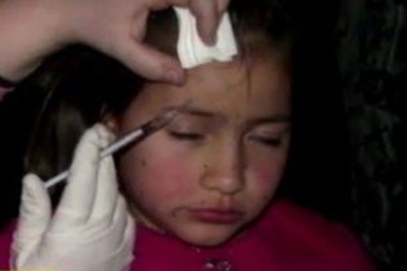 Matka wstrzykująca 8-latce botox ukarana! (VIDEO)