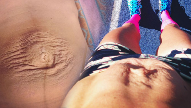 Zawsze była chudą biegaczką, po ciąży zostało jej TO (FOTO) Zawsze była chudą biegaczką, po ciąży zostało jej TO (FOTO)