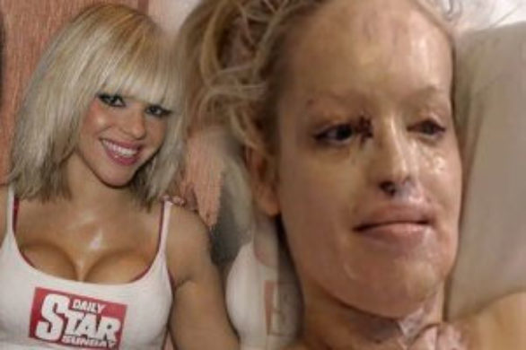 Tragiczna historia Katie Piper