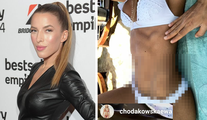 Ewa Chodakowska pokazała ciało w bikini i…. bliznę (FOTO) Ewa Chodakowska pokazała ciało w bikini i…. bliznę (FOTO)