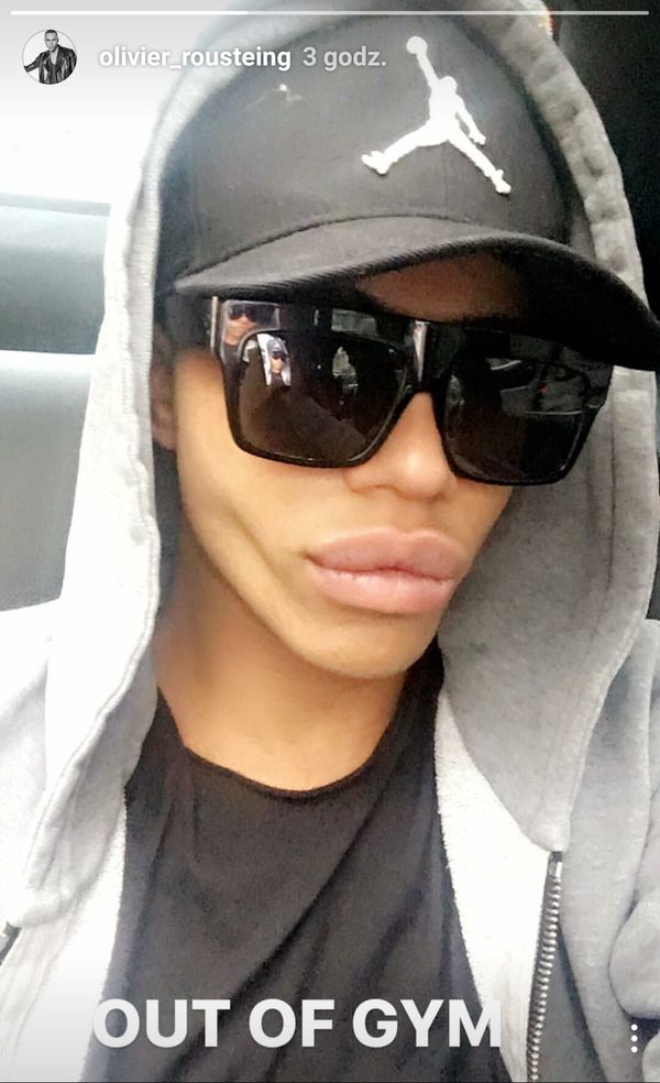 Olivier Rousteing stał się kolejną ofiarą operacji plastycznych? Olivier Rousteing stał się kolejną ofiarą operacji plastycznych?