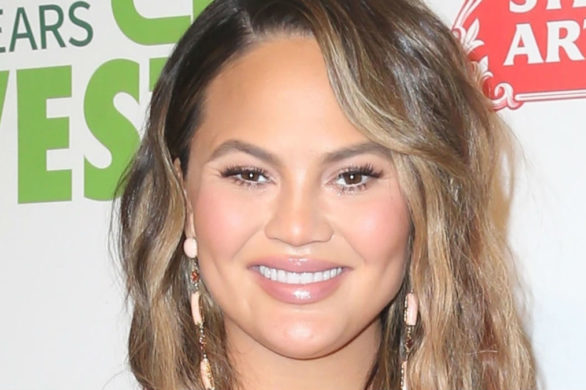 Chrissy Teigen pokazała się w plastrach oczyszczających! Fani pękają ze śmiechu!