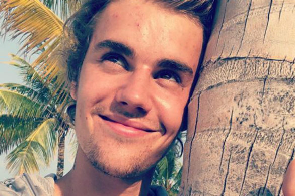 Cera Justina Biebera w coraz gorszym stanie. Takiego trądziku nie miał nigdy