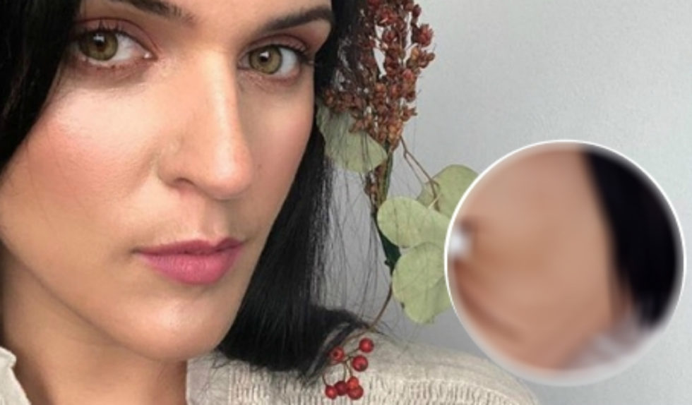 Modelka przez 20 lat ukrywała TO na swoich plecach! Teraz mówi o problemie