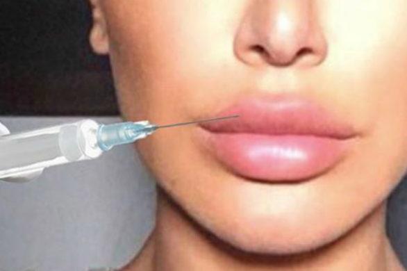 Huda Kattan przyznała się ze łzami w oczach, że musiała wyjąć wypełniacze z ust