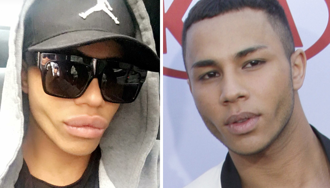 Olivier Rousteing stał się kolejną ofiarą operacji plastycznych? Olivier Rousteing stał się kolejną ofiarą operacji plastycznych?