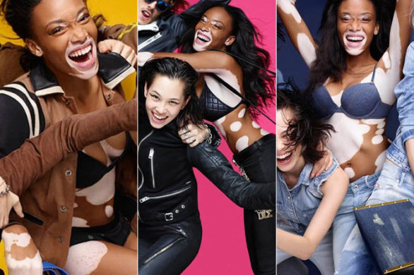 Modelka z bielactwem gwiazdą kampanii Diesel (FOTO)