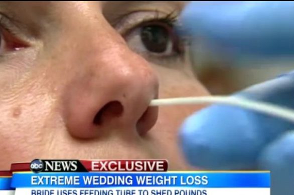 Drastyczna dieta przedślubna