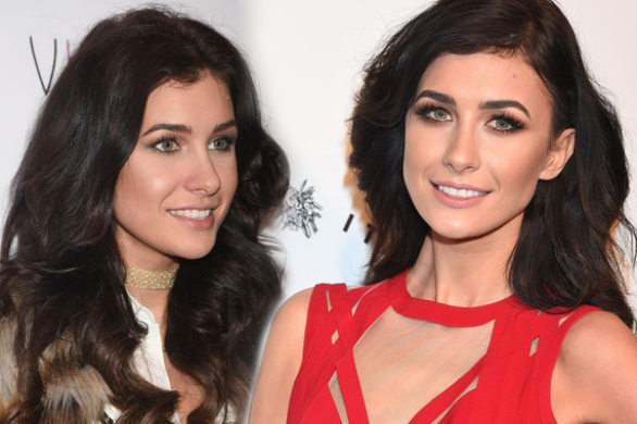 25-letnia Ewa Mielnicka przyznała się do botoksu i wywołała burzę (FOTO)