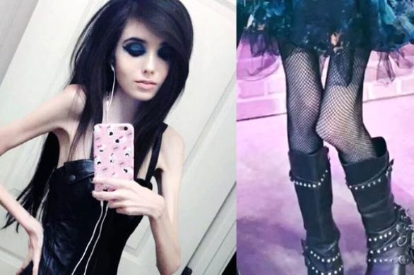 22-letnia anorektyczka Eugenia Cooney ma prawie milion subskrybentów