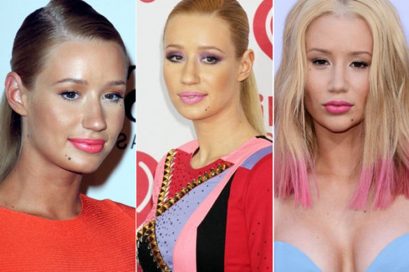 Iggy Azalea oddała twarz pod nóż (FOTO)