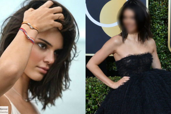 Co się stało z twarzą Kendall Jenner?! Jej usta są gigantyczne, a pryszcze…