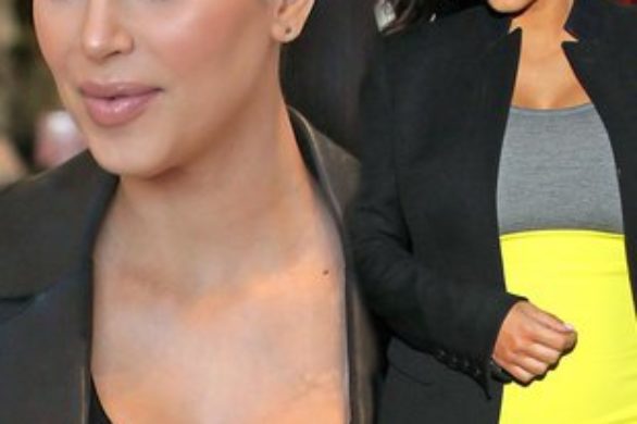 Kim Kardashian zamiast botoksu wybiera krew (FOTO)