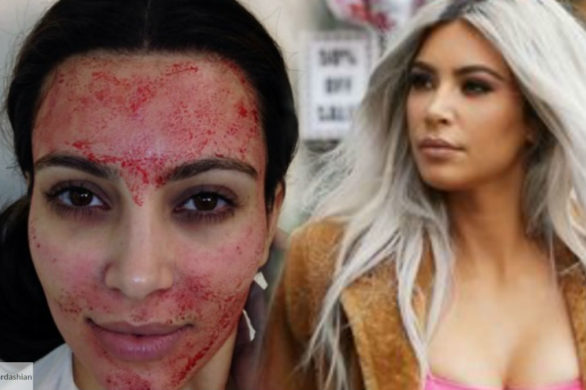 Pamiętacie wampirzy lifting Kim Kardashian? Celebrytka chce wymazać go z pamięci