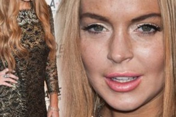 Koszmarne przebarwienia Lindsay Lohan (FOTO)