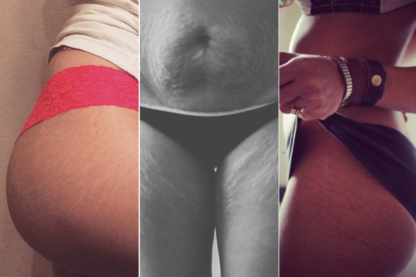 #loveyourlines – rozstępy zawładnęły Instagramem! (FOTO)