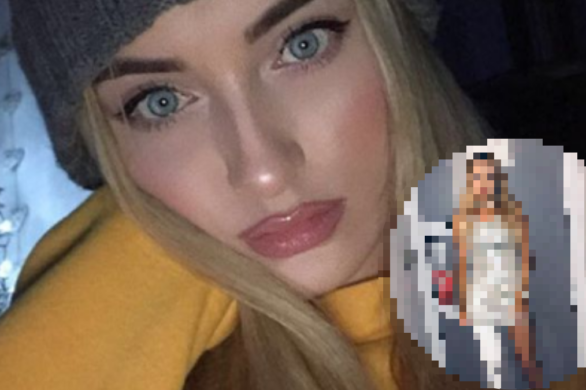 Ból w nodze skończył się amputacją. Kobieta wygrała walkę i dziś jest modelką